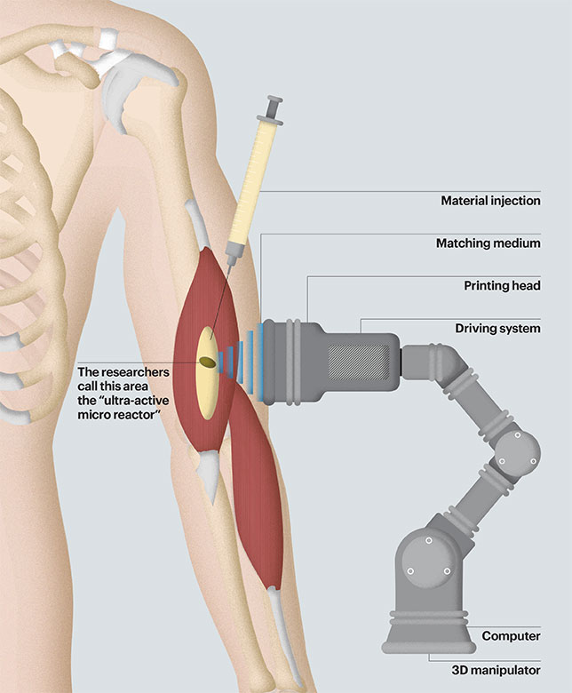 illustration of human arm.